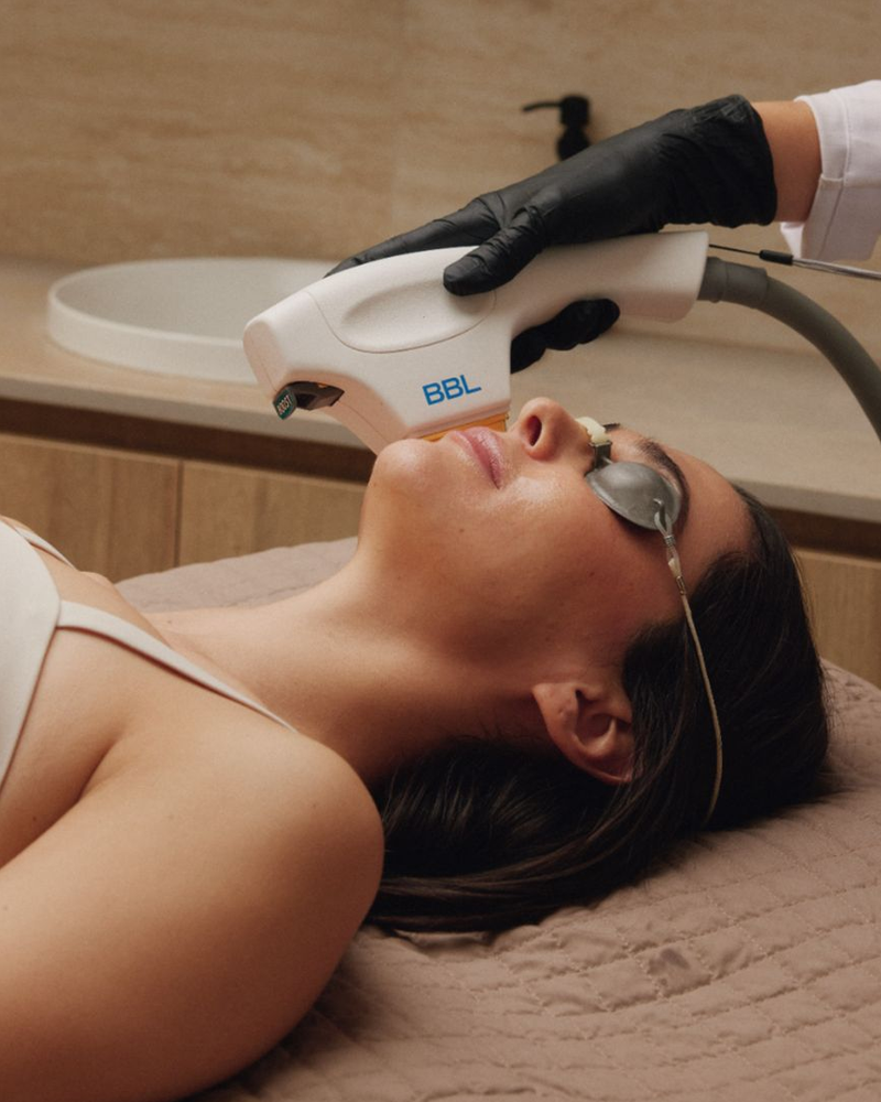 BBL Photofacial