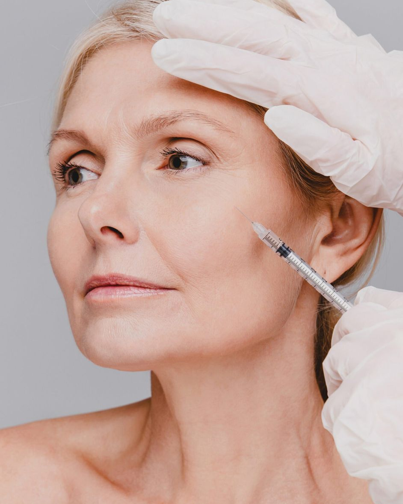 Sculptra Aesthetic