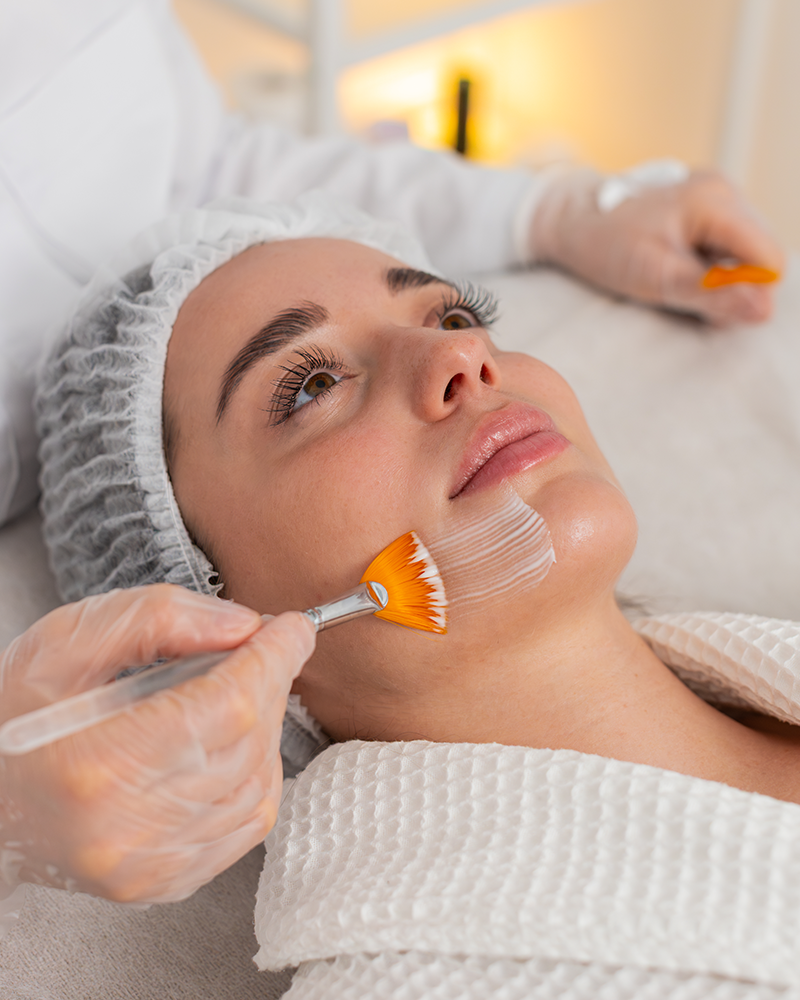 Chemical Peels