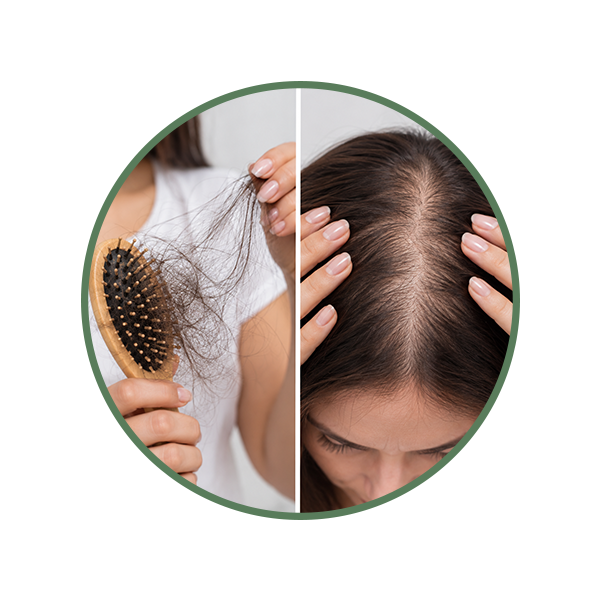 Increased Hair Shedding