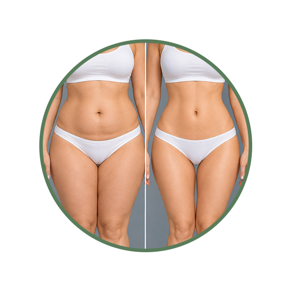 Refine Body Contours