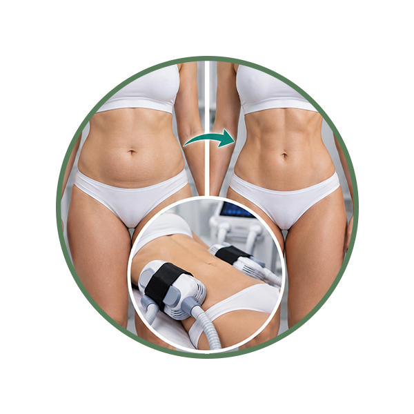 Body Definition