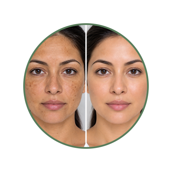 Sun Damage