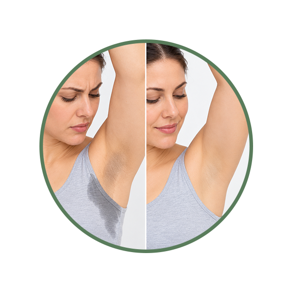 Underarm Sweating