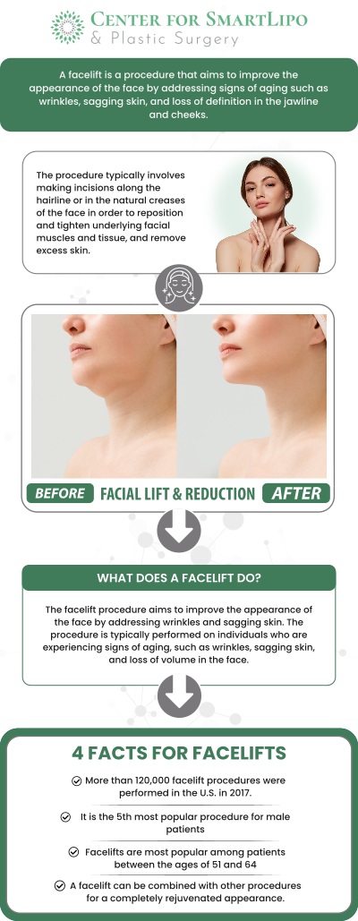 A facelift with SmartLipo in Philadelphia, PA, combines the benefits of traditional facial rejuvenation with the added advantages of advanced liposuction technology. Dr. Durvi Patel and Dr. Aaron Shapiro at the Center for SmartLipo & Plastic Surgery utilize SmartLipo to remove excess fat while tightening the skin, resulting in a more youthful, sculpted appearance. For more information, contact us or request an appointment online. We are conveniently located at 940 Town Center Dr Suite F20, Langhorne, PA 19047. A facelift with SmartLipo in Philadelphia, PA, combines the benefits of traditional facial rejuvenation with the added advantages of advanced liposuction technology. Dr. Durvi Patel and Dr. Aaron Shapiro at the Center for SmartLipo & Plastic Surgery utilize SmartLipo to remove excess fat while tightening the skin, resulting in a more youthful, sculpted appearance. For more information, contact us or request an appointment online. We are conveniently located at 940 Town Center Dr Suite F20, Langhorne, PA 19047.