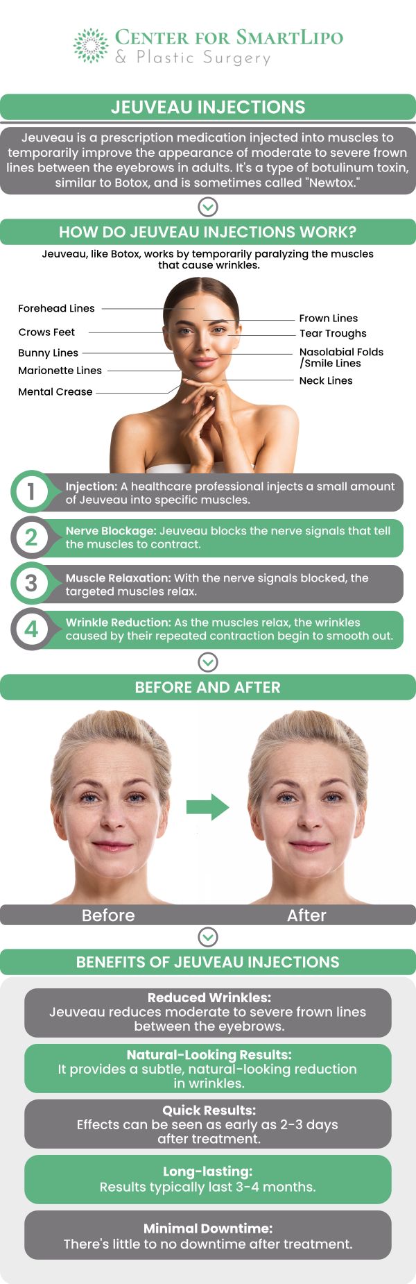 Jeuveau injection costs in the Philadelphia, PA area are determined on a per-unit basis. The final price for common treatment areas like the forehead or frown lines will vary based on the specific number of units necessary to achieve your desired aesthetic results. For more information, contact us or request an appointment online. We serve patients from Langhorne PA, and surrounding areas. Jeuveau injection costs in the Philadelphia, PA area are determined on a per-unit basis. The final price for common treatment areas like the forehead or frown lines will vary based on the specific number of units necessary to achieve your desired aesthetic results. For more information, contact us or request an appointment online. We serve patients from Langhorne PA, and surrounding areas.