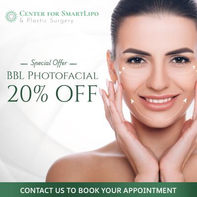 Special Offer - BBL Photofacial 20% Off - Center for SmartLipo & Plastic Surgery in Langhorne, and Philadelphia, PA